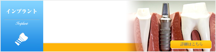 �C���v�����g