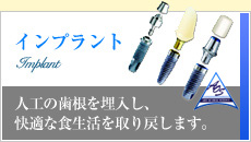 �C���v�����g